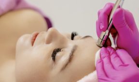 чистка лица киев